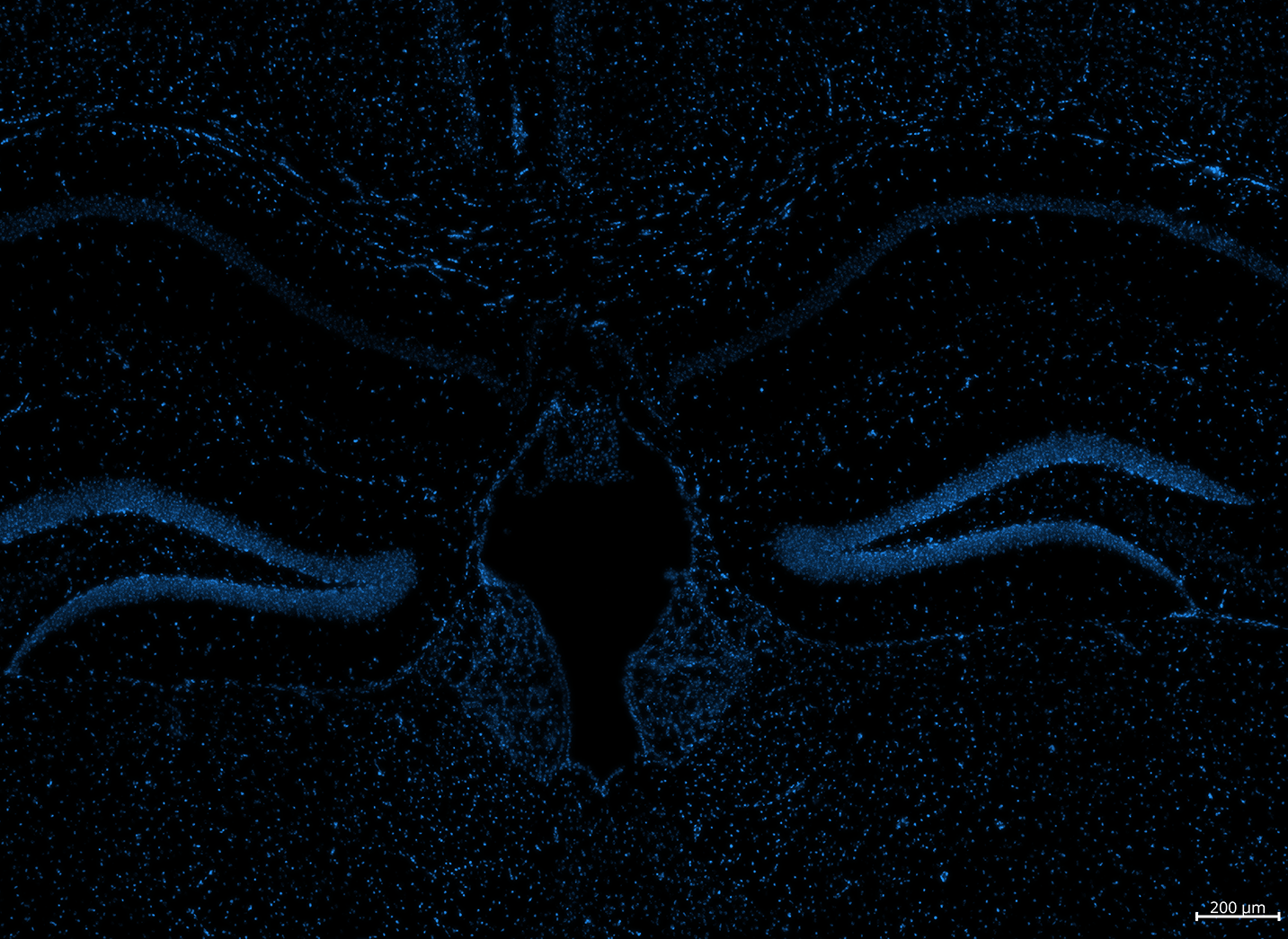 zoom out screenshot