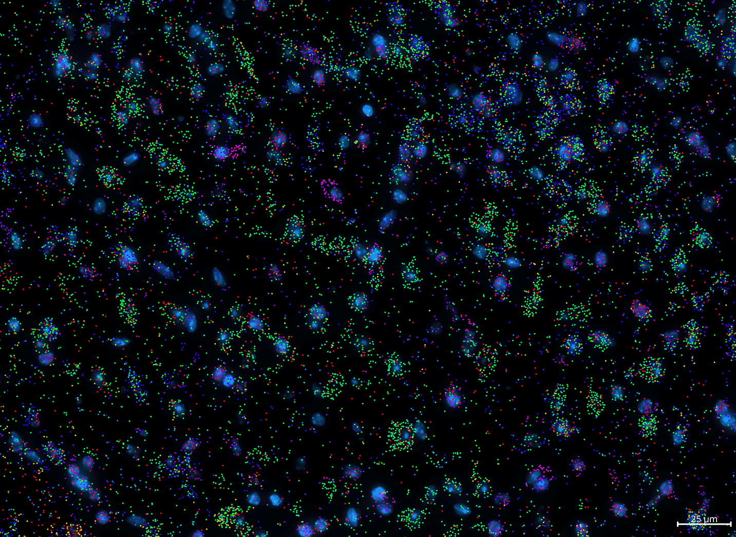zoom out screenshot