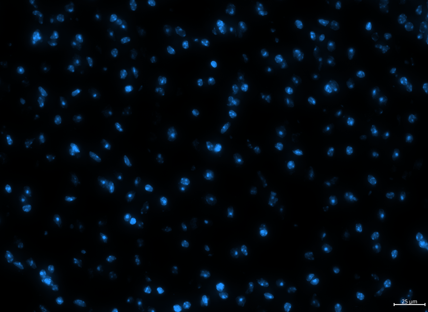 zoom out screenshot